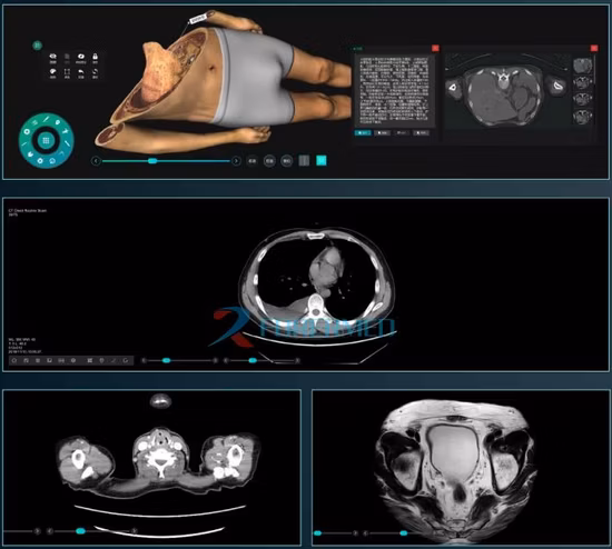 Новый заводской медицинский анатомический анатомический 3D-дисплей для школьного цифрового виртуального аутопсии